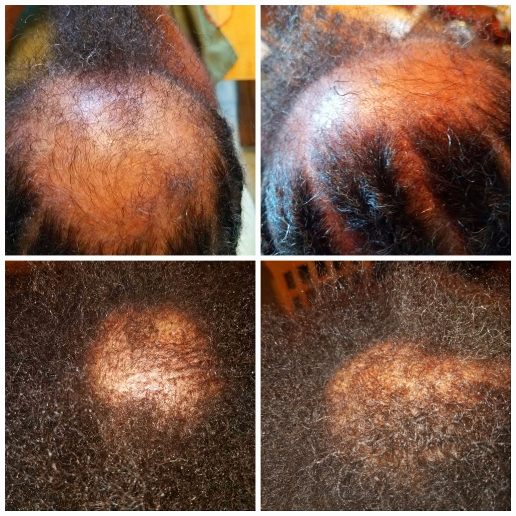 Nutrient Rich Hair / Scalp Elixir