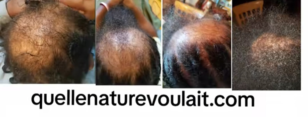 Foodie Hair Grease / Scalp Food